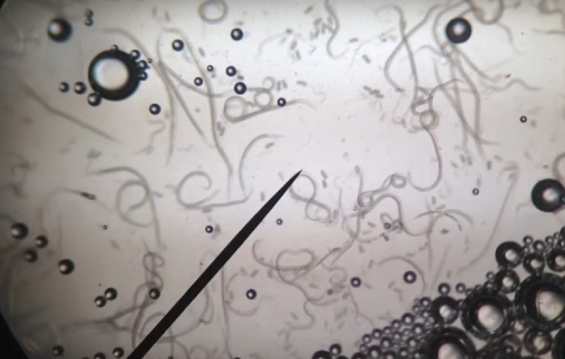 Стеблевая нематода в зелени чеснока под микроскопом